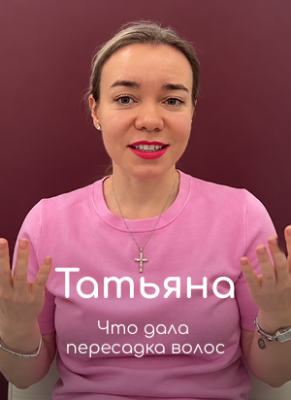 Отзыв пациента о пересадке волос — Татьяна